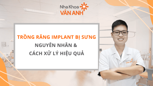 Trồng Răng Implant Bị Sưng