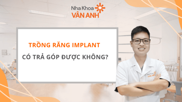 Trồng răng implant có trả góp được không