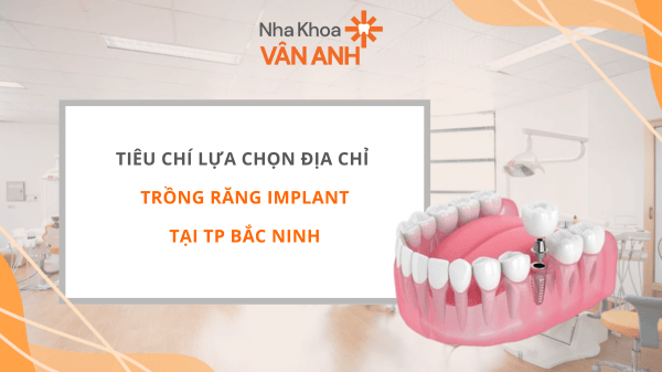 địa chỉ trồng răng implant tại tp bắc ninh