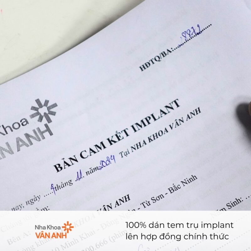 hợp đồng trồng implant