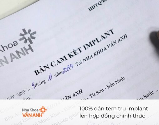 hợp đồng trồng implant