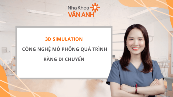 mô phỏng quá trình răng di chuyển