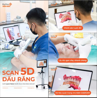 quét dấu răng scan 5d nha khoa vân anh