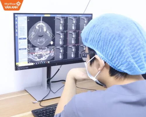 trồng răng implant