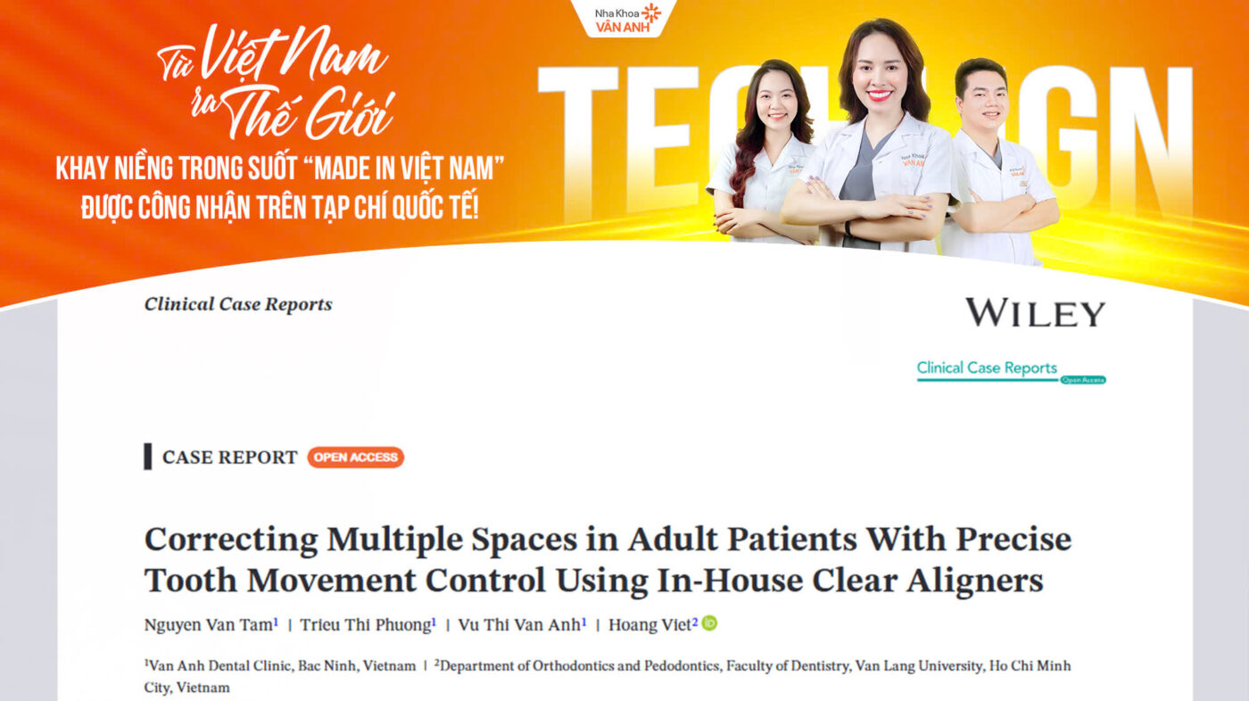 niềng răng trong suốt techlign có tốt không