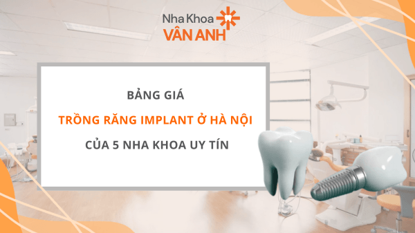 trồng răng implant ở Hà Nội