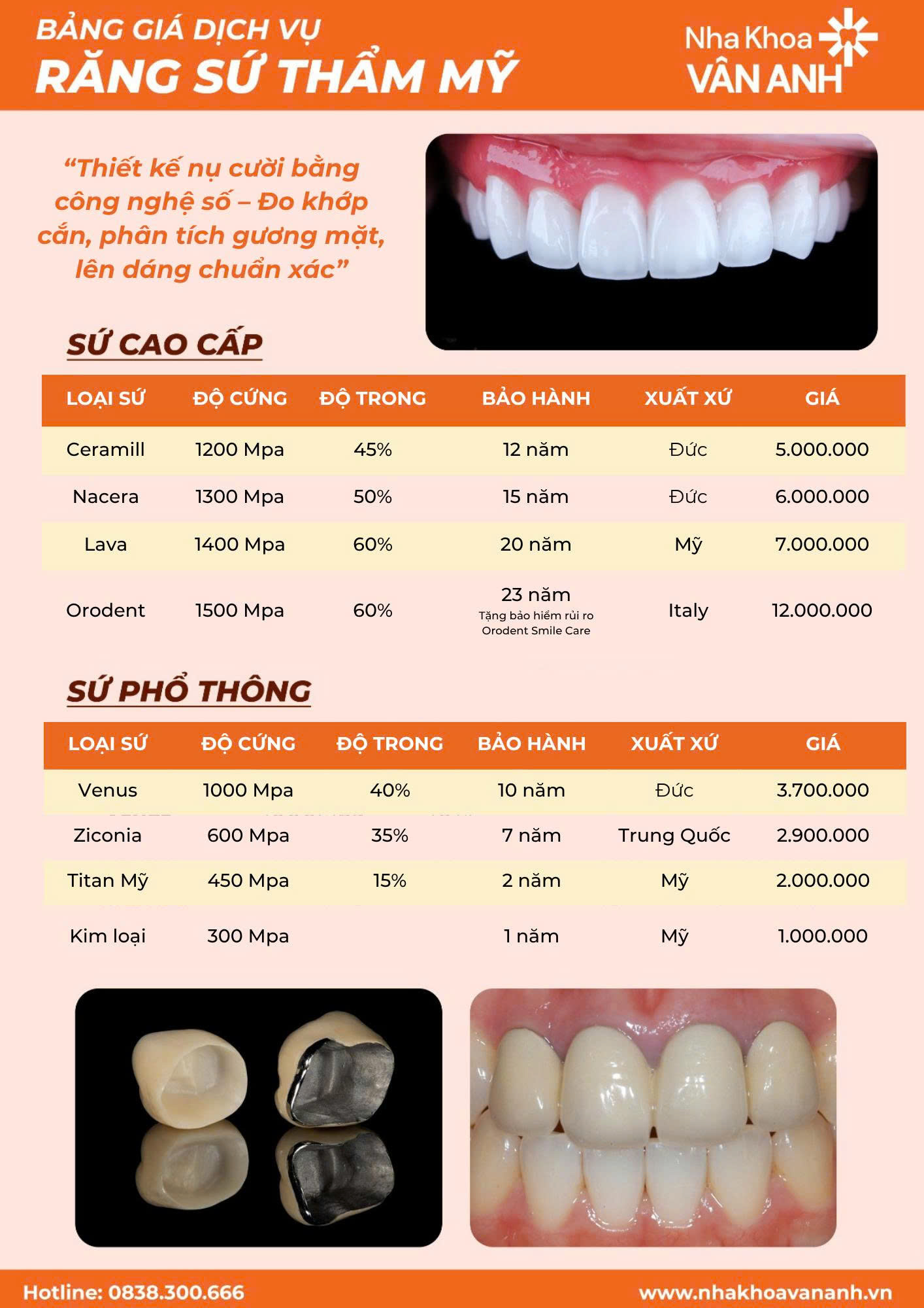 bảng giá răng sứ thẩm mỹ