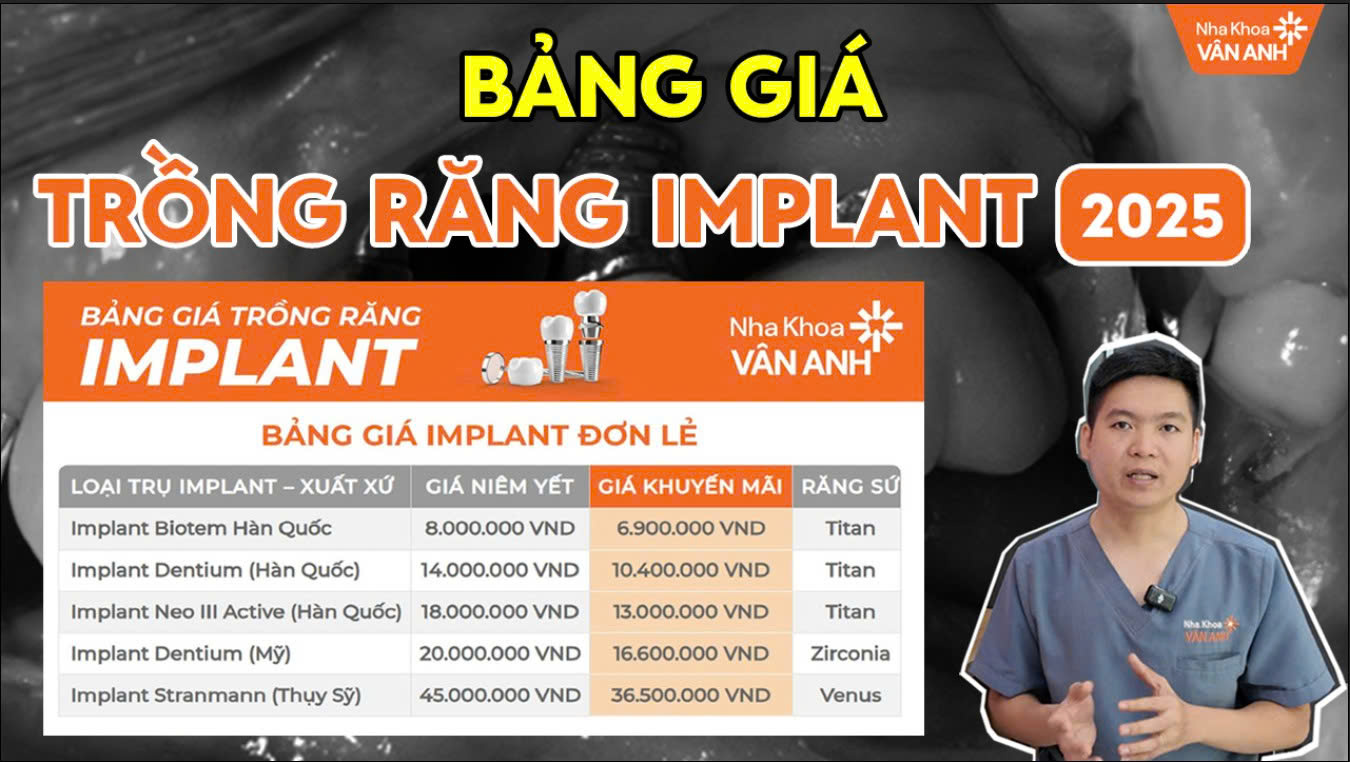 bảng giá trồng răng implant 2025