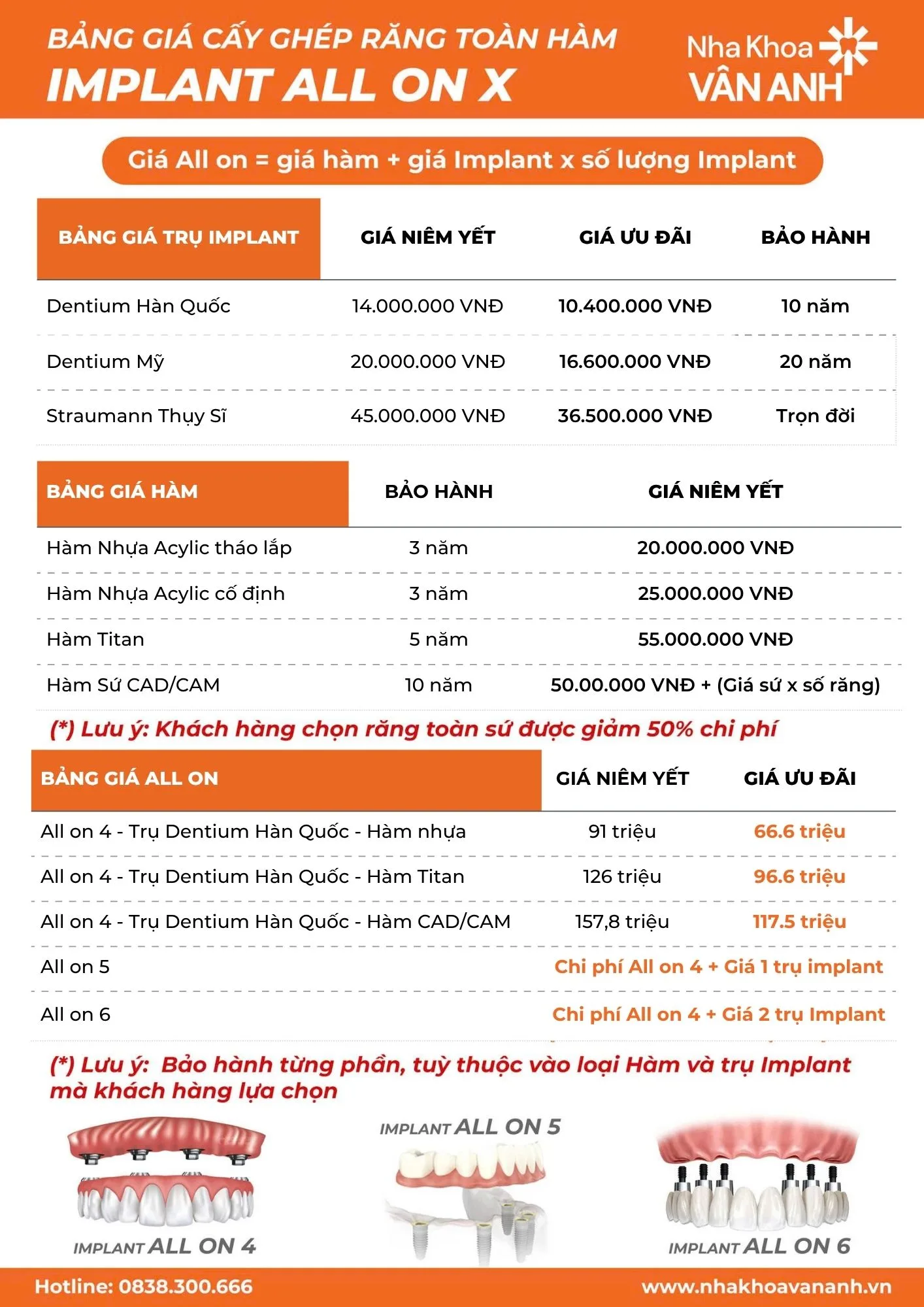 bảng giá trồng răng toàn hàm nha khoa vân anh