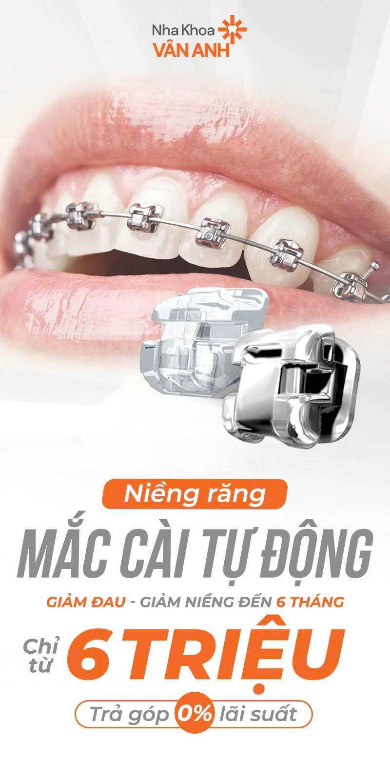 ưu đãi niềng răng