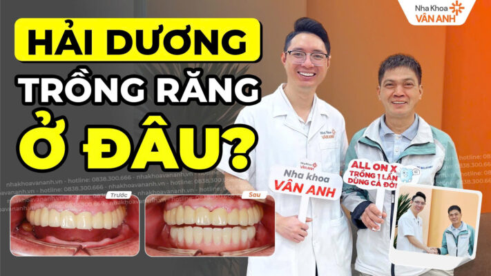 trồng răng ở hải dương