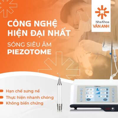 nhổ răng khôn máy piezotome