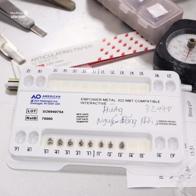 niềng răng nha khoa vân anh