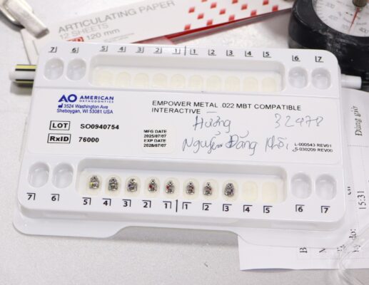 niềng răng nha khoa vân anh hưng yên