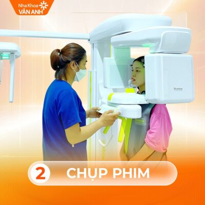 quy trình nhổ răng khôn