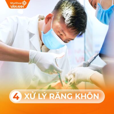 quy trình nhổ răng khôn