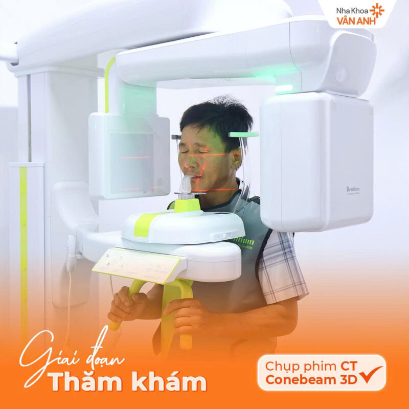 trồng răng ở hải dương