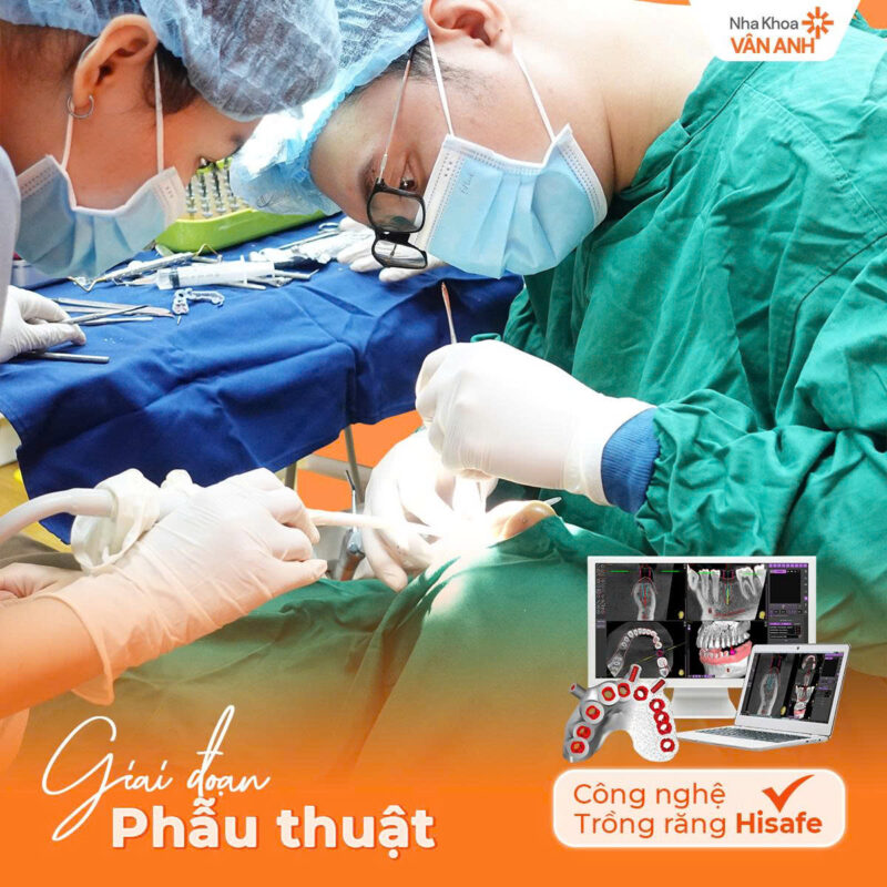 trồng răng ở hải dương