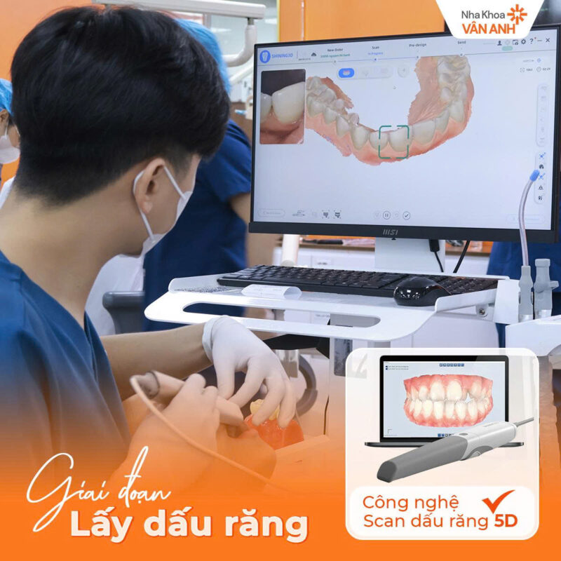 trồng răng ở hải dương