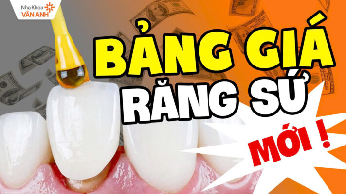 bảng giá răng sứ mới nhất