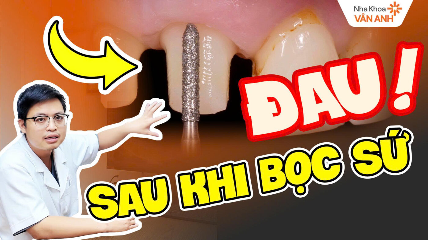 đau sau khi bọc sứ