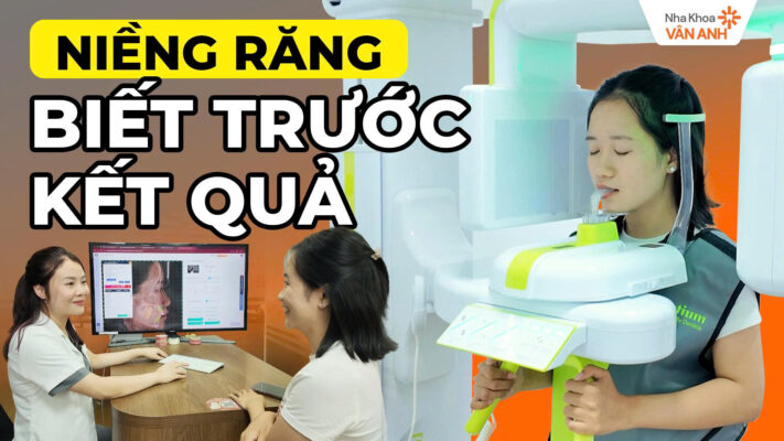 niềng răng biết trước kết quả nha khoa vân anh