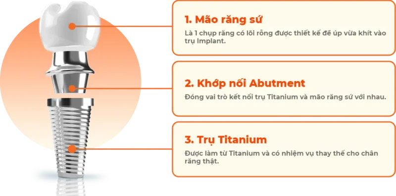 CẤU TẠO TRỤ IMPLANT