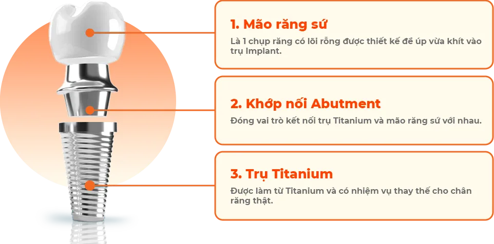 CẤU TẠO TRỤ IMPLANT
