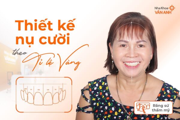 bọc răng sứ nha khoa vân anh