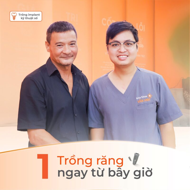 trồng răng implant mất bao lâu