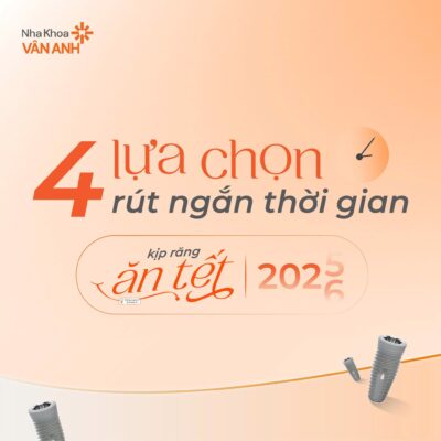 trồng răng implant mất bao lâu thời gian