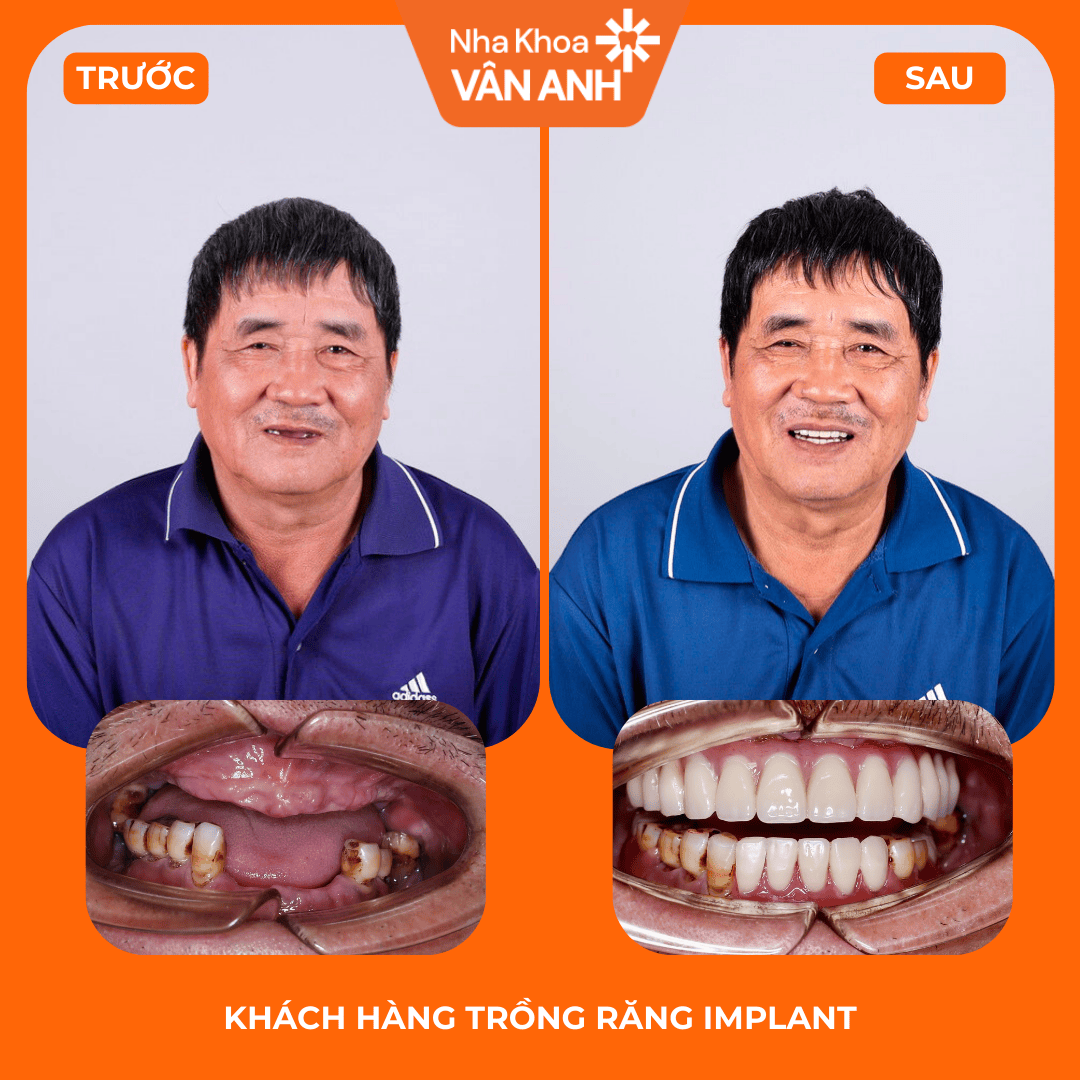 Ca 01 trước và sau điều trị