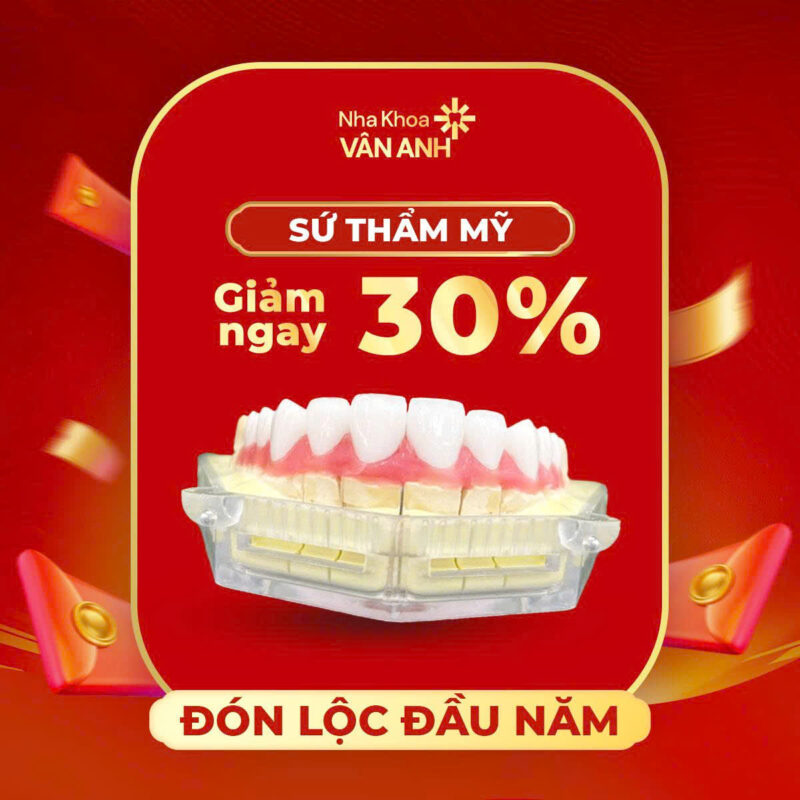 ưu đãi răng sứ