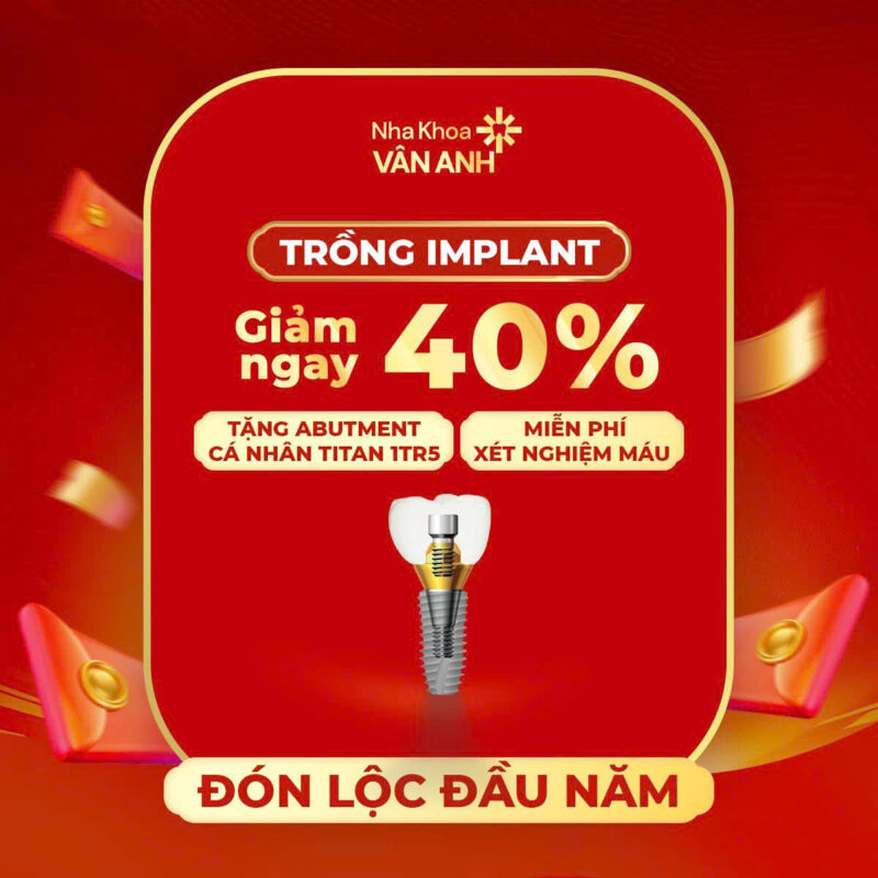 ƯU ĐÃI TRỒNG RĂNG IMPLANT KHAI XUÂN