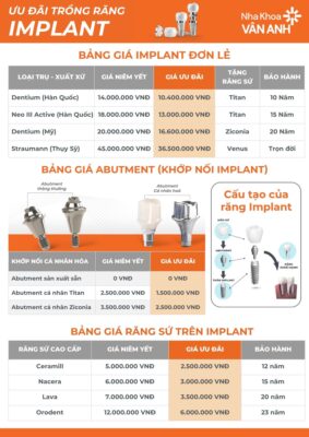 bảng giá trồng răng implant nha khoa vân anh mới nhất