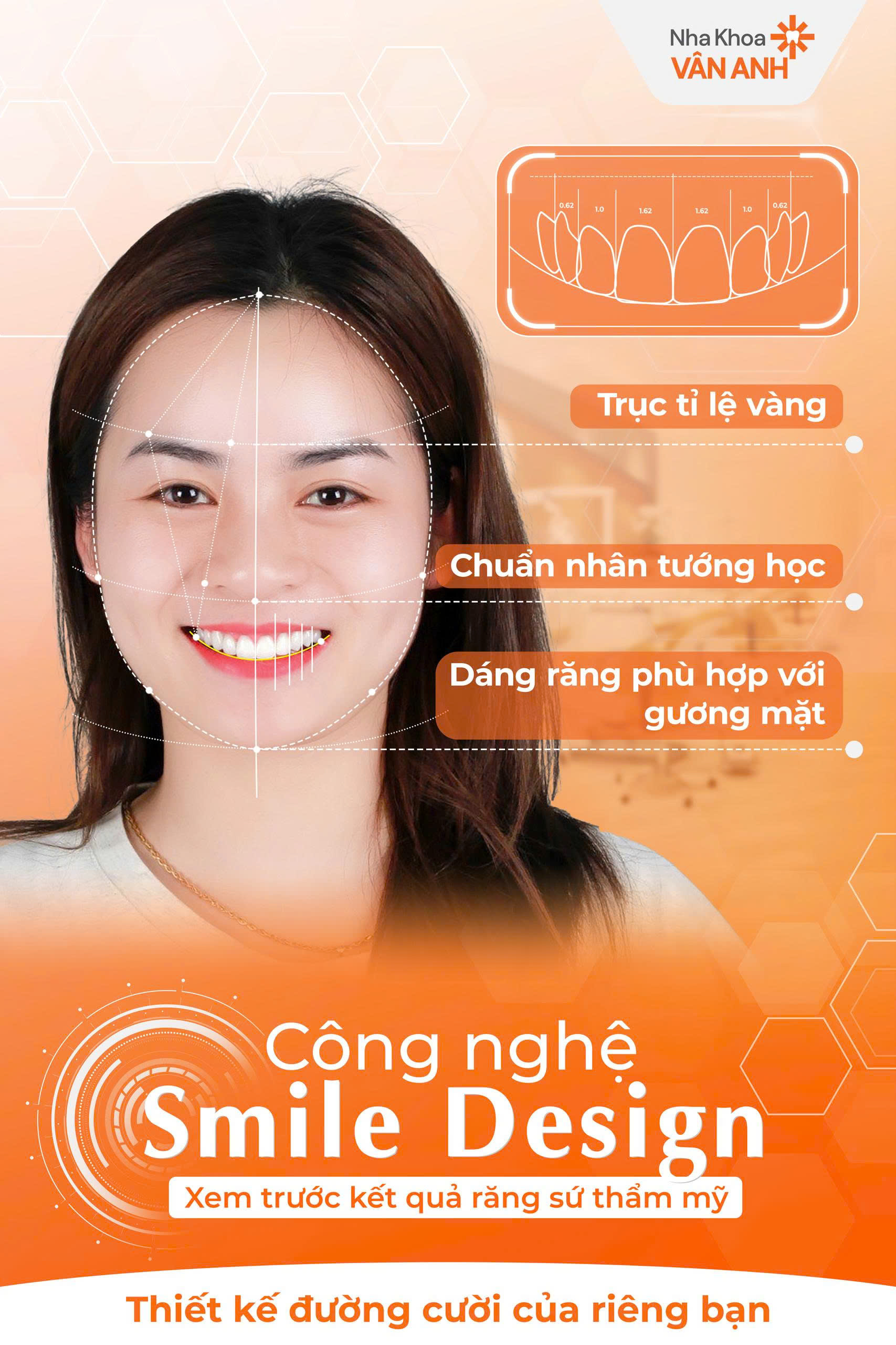 công nghệ răng sứ thẩm mỹ smile design