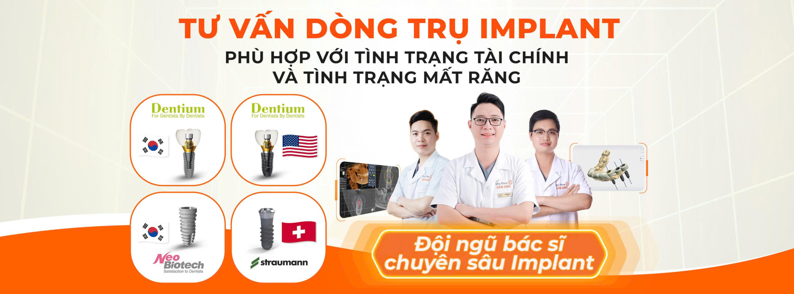 tư vấn trụ implant