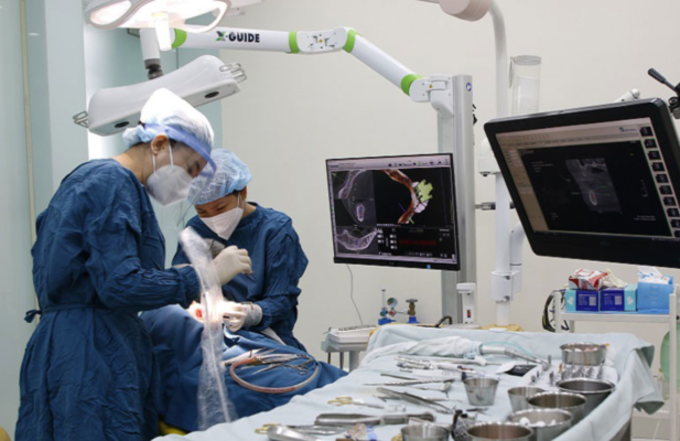 công nghệ x-guide