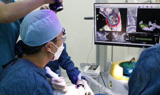 công nghệ x-guide