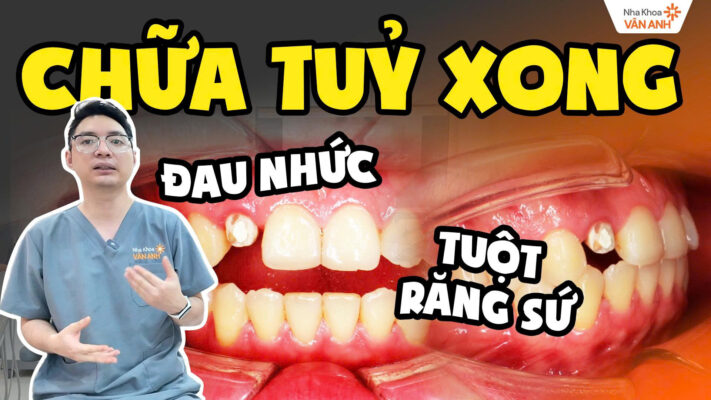 đau nhức tuột răng sứ