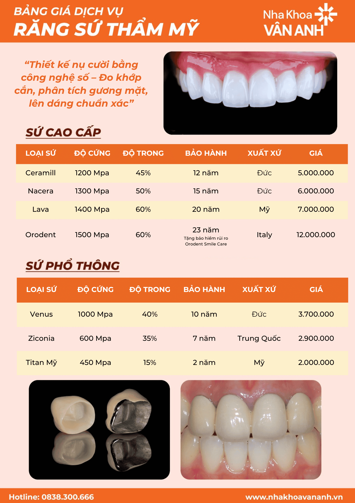 Bảng giá răng sứ nha khoa vân anh