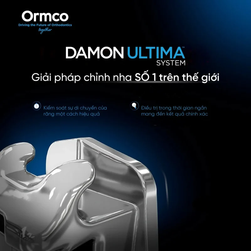 Damon ultima có tốt không